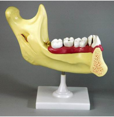 Модель Строение челюсти человека